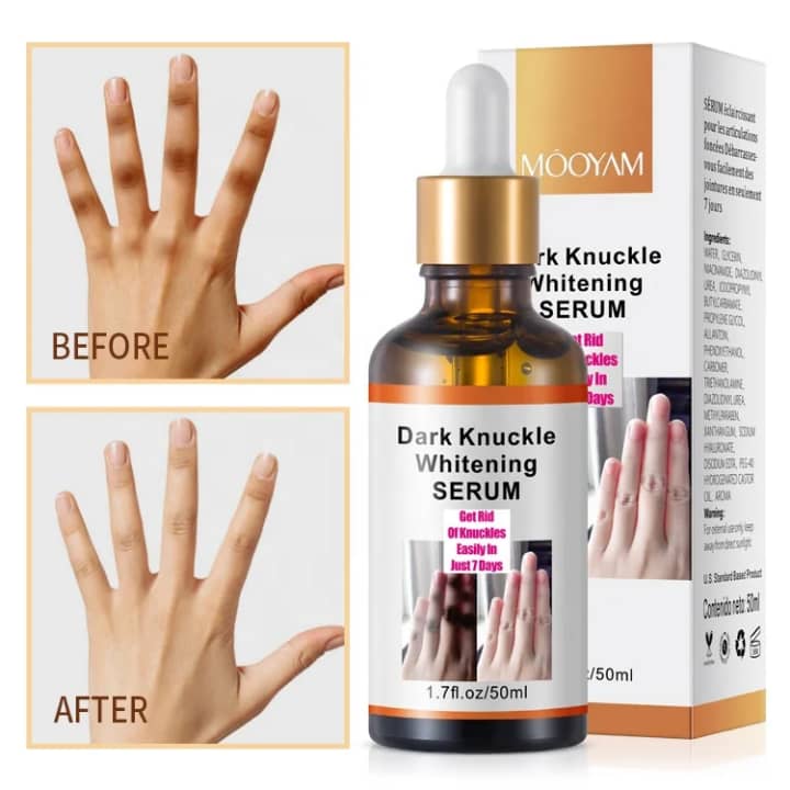Sérum Anti-Taches pour Jointures – Soin Unifiant pour les Doigts, les Phalanges et les Coudes