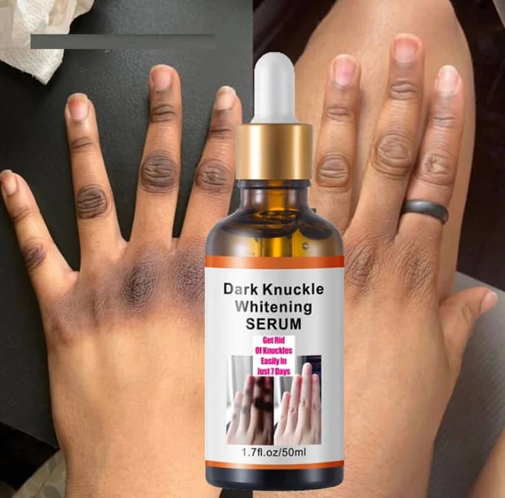 Sérum Anti-Taches pour Jointures – Soin Unifiant pour les Doigts, les Phalanges et les Coudes