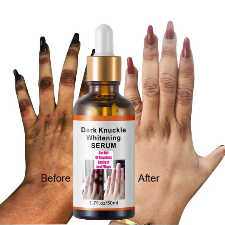 Sérum Anti-Taches pour Jointures – Soin Unifiant pour les Doigts, les Phalanges et les Coudes
