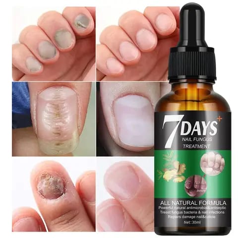 Spray Soin des Ongles au Gingembre – Solution Nourrissante pour des Ongles Plus Sains et Soignés