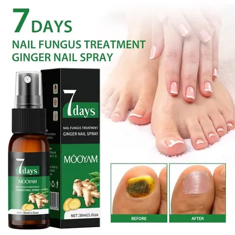 Spray Soin des Ongles au Gingembre – Solution Nourrissante pour des Ongles Plus Sains et Soignés