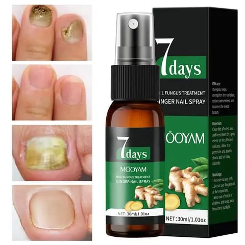 Spray Soin des Ongles au Gingembre – Solution Nourrissante pour des Ongles Plus Sains et Soignés