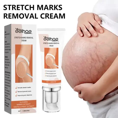 Crème Anti-Vergetures Végane – Soin Réparateur Doux pour une Peau Plus Lisse et Souple