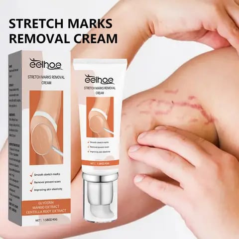 Crème Anti-Vergetures Végane – Soin Réparateur Doux pour une Peau Plus Lisse et Souple
