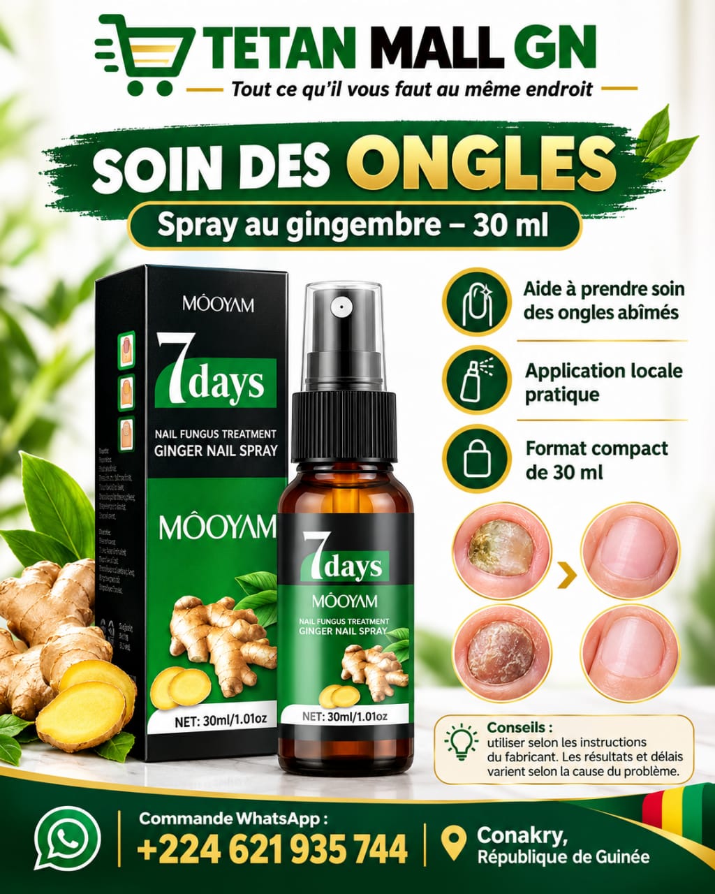 Spray Soin des Ongles au Gingembre – Solution Nourrissante pour des Ongles Plus Sains et Soignés